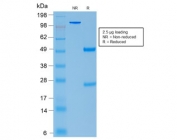 SDS-PAGE analysis of purified, BSA-free recombinant ACTH antibody (clone CLIP/2040R) as confirmation of integrity and purity.