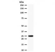 Western blot testing of  human MCF7 cell lysate with recombinant Bcl2 antibody (clone ARBC2-2R). Expected molecular weight ~26 kDa.