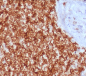 IHC testing of FFPE human spleen tissue with recombinant Bcl-2 antibody (clone ARBC2-2R). HIER: boil tissue sections in 1mM EDTA buffer, pH 7.5-8.5, for 10-20 min followed by cooling at RT for 20 min.~