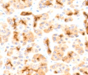 IHC testing of FFPE human pancreas with recombinant CFTR antibody (clone CFTR1-2R). HIER: boil tissue sections in 10mM Tris with 1mM EDTA, pH9 for 10-20 min followed by cooling at RT for 20 min.