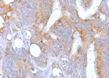 IHC testing of FFPE human colon with recombinant CD86 antibody (CDLA86-2R). Required HIER: boil tissue sections in 10mM Tris buffer with 1mM EDTA, pH 9.0, for 10-20 min followed by cooling at RT for 20 min.~