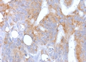 IHC testing of FFPE human colon with recombinant CD86 antibody (CDLA86-2R). Required HIER: boil tissue sections in 10mM Tris buffer with 1mM EDTA, pH 9.0, for 10-20 min followed by cooling at RT for 20 min.