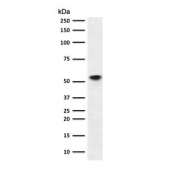 Western blot testing of human Ramos cell lysate with recombinant CD86 antibody (clone CDLA86-2R). Expected molecular weight: 38-70 kDa depending on glycosylation level.