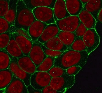 Immunofluorescent staining of human HeLa cells with recombinant Beta Catenin antibody (clone CTNB1-1R, green) and Reddot nuclear stain (red).~