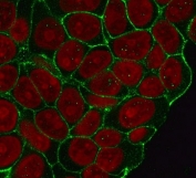 Immunofluorescent staining of human HeLa cells with recombinant Beta Catenin antibody (clone CTNB1-1R, green) and Reddot nuclear stain (red).