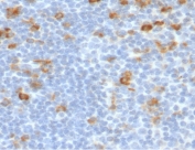 IHC testing of FFPE human tonsil stained with Kappa light chain antibody (clone KC3L-2). Required HIER: boil sections in 10mM citrate buffer, pH6, for 10-20 min followed by cooling at RT for 20 min.