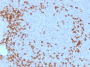 IHC testing of human spleen tissue with CD3e antibody (clone C3e/1931). Required HIER: boil tissue sections in 10mM citrate buffer, pH 6.0, for 10-20 min.