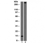 Western blot testing of 1) partial recombinant protein and 2) human lung lysate with recombinant von Willebrand Factor antibody (clone rVWF/1465). Predicted molecular weight ~250 kDa.