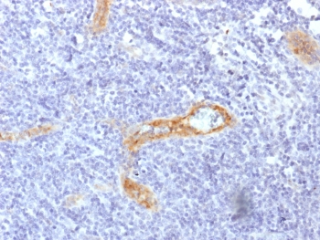 IHC testing of FFPE human tonsil with recombinant von Willebrand Factor antibody (clone rVWF/1465). Required HIER: boil tissue sections in pH 9 10mM Tris with 1mM EDTA for 10-20 min followed by cooling at RT for 20 min.~