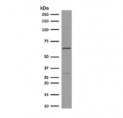 Western blot testing of human MCF7 cell lysate with recombinant Estrogen Receptor antibody (clone NR3Ga-4R). Predicted molecular weight ~67 kDa.