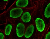 Immunofluorescent staining of PFA-fixed human HeLa cells with recombinant Histone H1 antibody (green, clone OSHT-3R) and Phalloidin.