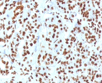IHC staining of FFPE human pancreas tissue with recombinant Histone H1 antibody (clone OSHT-3R). Required HIER: boil tissue sections in pH 9 10mM Tris with 1mM EDTA for 10-20 min.