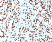 IHC staining of FFPE human pancreas tissue with recombinant Histone H1 antibody (clone OSHT-3R). Required HIER: boil tissue sections in pH 9 10mM Tris with 1mM EDTA for 10-20 min.