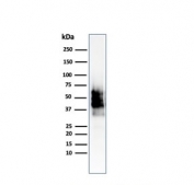 Western blot testing of human COLO-38 cell lysate with recombinant SOX10 antibody (clone SOX10/2311R). Expected molecular weight: 50-58 kDa.