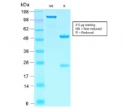 SDS-PAGE analysis of purified, BSA-free recombinant SOX10 antibody (clone SOX10/2311R) as confirmation of integrity and purity.