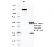 SDS-PAGE analysis of purified, BSA-free Cadherin 16 antibody (clone CDH16/2125) as confirmation of integrity and purity.