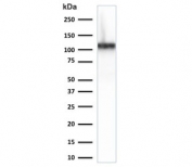 Western blot testing of human kidney lysate with Cadherin 16 antibody (clone CDH16/2125). Expected molecular weight: 90~130 kDa.
