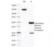 SDS-PAGE analysis of purified, BSA-free CDH16 antibody as confirmation of integrity and purity.