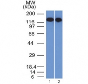 Western blot testing of FFPE human 1) Raji and 2) Ramos cell lysate with CD22 antibody (clone BLCAM/1795). Expected molecular weight: 76/95 kDa (alpha/beta, unmodified), 130-150 kDa (glycosylated).