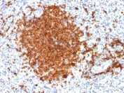 IHC testing of FFPE human spleen tissue with CD22 antibody (clone BLCAM/1795). HIER: boil tissue sections in 10mM citrate buffer, pH 6, for 10-20 min followed by cooling at RT for 20 min.