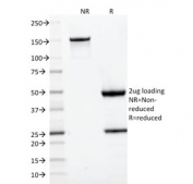 SDS-PAGE analysis of purified, BSA-free CD22 antibody (clone BLCAM/1795) as confirmation of integrity and purity.