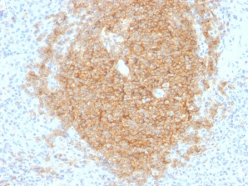 IHC testing of human spleen tissue with CD40 antibody (clone C40/1605). Required HIER: boil tissue sections in 10mM citrate buffer, pH 6, for 10-20 min.~