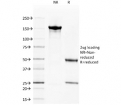 SDS-PAGE analysis of purified, BSA-free CD40 antibody (clone C40/1605) as confirmation of integrity and purity.