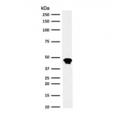 Western blot testing of human Raji cell lysate with recombinant CD79a antibody (clone CDLA79a-3R). Expected molecular weight: 25-47 kDa depending on glycosylation level.