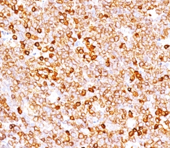 IHC testing of FFPE human tonsil with recombinant CD79a antibody (clone CDLA79a-3R). Required HIER: boil tissue sections in pH 9 10mM Tris with 1mM EDTA followed by cooling at RT for 20 min.