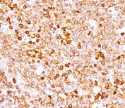 IHC testing of FFPE human tonsil with recombinant CD79a antibody (clone CDLA79a-3R). Required HIER: boil tissue sections in pH 9 10mM Tris with 1mM EDTA followed by cooling at RT for 20 min.