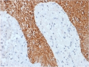 IHC staining of FFPE human skin with recombinant Multi Cytokeratin antibody (clone KRT/1877R). HIER: boil tissue sections in pH 9 10mM Tris with 1mM EDTA for 10-20 min followed by cooling at RT for 20 min.