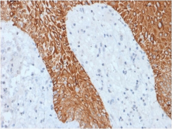 IHC staining of FFPE human skin with recombinant Multi Cytokeratin antibody (clone KRT/1877R). HIER: boil tissue sections in pH 9 10mM Tris with 1mM EDTA for 10-20 min followed by cooling at RT for 20 min.~