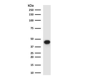 Western blot testing of human lung lysate with EpCAM antibody (clone EPM17-5R). Expected molecular weight: ~35 kDa (unmodified), 40-43 kDa (glycosylated).~