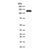 Western blot testing of human MCF-7 cell lysate with recombinant E-Cadherin antibody (clone ECD1-3R). Expected molecular weight: 135 kDa (precursor), 80-120 kDa (mature, depending on glycosylation level).