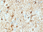 IHC testing of FFPE human cerebellum tissue with recombinant GFAP antibody (clone GFA12-4R). Required HIER: boil tissue sections in pH6, 10mM citrate buffer, for 10-20 min followed by cooling at RT for 20 min.