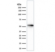 Western blot testing of human HeLa cell lysate with recombinant Cytokeratin 7 antibody (clone rOV-TL12/30).