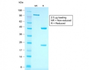 SDS-PAGE analysis of purified, BSA-free recombinant Cytokeratin 7 antibody (clone rOV-TL12/30) as confirmation of integrity and purity.