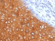 IHC testing of FFPE human skin with recombinant Cytokeratin 10 antibody (clone CTKN10-2R). Required HIER: boil tissue sections in pH 9 10mM Tris with 1mM EDTA for 10-20 min followed by cooling at RT for 20 min.