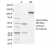 SDS-PAGE analysis of purified, BSA-free Bcl6 antibody (clone BCL6/1982) as confirmation of integrity and purity.