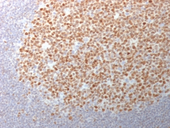 IHC testing of FFPE human tonsil tissue with Bcl6 antibody (clone BCL6/1982). Required HIER: boil tissue sections in 10mM Tris with 1mM EDTA, pH 9, for 10-20 min.~