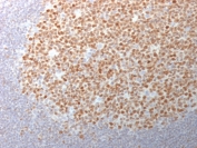 IHC testing of FFPE human tonsil tissue with Bcl6 antibody (clone BCL6/1982). Required HIER: boil tissue sections in 10mM Tris with 1mM EDTA, pH 9, for 10-20 min.