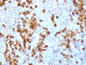 IHC staining of FFPE human tonsil tissue with recombinant Kappa light chain antibody (clone KC3L-3R). Required HIER: boil tissue sections in pH6, 10mM citrate buffer, for 10-20 min followed by cooling at RT for 20 min.