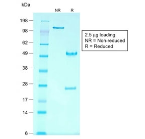 SDS-PAGE analysis of purified, BSA-free recombinant GPC3 antibody (clone rGPC3/863) as confirmation of integrity and purity.