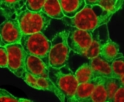 Immunofluorescent staining of methanol-fixed HepG2 cells with recombinant Glypican 3 antibody (green, clone SGPN3-2R) and Reddot nuclear stain (red).