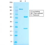 SDS-PAGE analysis of purified, BSA-free recombinant Melan-A antibody (clone rMLANA/788) as confirmation of integrity and purity.