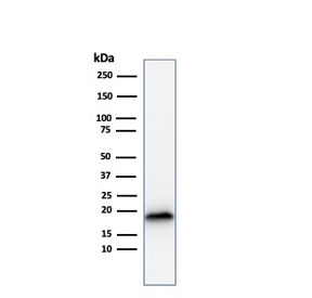Western blot testing of human COLO-38 cell lysate with recombinant Melan-A antibody (clone rMLANA/788). Expected molecular weight ~20 kDa with possible doublet.~