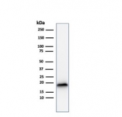 Western blot testing of human COLO-38 cell lysate with recombinant Melan-A antibody (clone rMLANA/788). Expected molecular weight ~20 kDa with possible doublet.