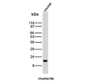Western blot testing of human COLO-38 cell lysate with recombinant Melan-A antibody (clone rMLANA/788). Expected molecular weight ~20 kDa with possible doublet.
