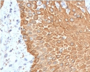 IHC staining of FFPE human skin with recombinant Multi Cytokeratin antibody (clone CTKNM-1R). HIER: boil tissue sections in 10mM citrate buffer, pH 6, for 10-20 min followed by cooling at RT for 20 min.