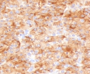 IHC analysis of FFPE human parathyroid gland stained with recombinant Chromogranin A antibody (clone bGRAN2R). Required HIER: steam sections in pH6 citrate buffer for 10-20 min and allow to cool at RT for 20 min before testing.